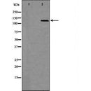 DF6582 staining HepG2 by IF/ICC. The sample were fixed with PFA and permeabilized in 0.1% Triton X-100,then blocked in 10% serum for 45 minutes at 25¡ãC. The primary antibody was diluted at 1/200 and incubated with the sample for 1 hour at 37¡ãC. An  Alexa Fluor 594 conjugated goat anti-rabbit IgG (H+L) Ab, diluted at 1/600, was used as the secondary antibod