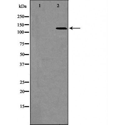 DF6582 staining HepG2 by IF/ICC. The sample were fixed with PFA and permeabilized in 0.1% Triton X-100,then blocked in 10% serum for 45 minutes at 25¡ãC. The primary antibody was diluted at 1/200 and incubated with the sample for 1 hour at 37¡ãC. An  Alexa Fluor 594 conjugated goat anti-rabbit IgG (H+L) Ab, diluted at 1/600, was used as the secondary antibod