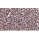 Western blot analysis of extracts from Rat  brain, using GABRG2 Antibody. The lane on the left was treated with blocking peptide.
