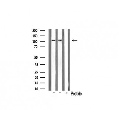 AF0528 staining HuvEc by IF/ICC. The sample were fixed with PFA and permeabilized in 0.1% Triton X-100,then blocked in 10% serum for 45 minutes at 25¡ãC. The primary antibody was diluted at 1/200 and incubated with the sample for 1 hour at 37¡ãC. An  Alexa Fluor 594 conjugated goat anti-rabbit IgG (H+L) Ab, diluted at 1/600, was used as the secondary antibod