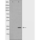 DF6590 at 1/100 staining Mouse testis tissue by IHC-P. The sample was formaldehyde fixed and a heat mediated antigen retrieval step in citrate buffer was performed. The sample was then blocked and incubated with the antibody for 1.5 hours at 22¡ãC. An HRP conjugated goat anti-rabbit antibody was used as the secondary