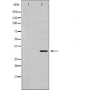 DF6592 at 1/100 staining Rat liver tissue by IHC-P. The sample was formaldehyde fixed and a heat mediated antigen retrieval step in citrate buffer was performed. The sample was then blocked and incubated with the antibody for 1.5 hours at 22¡ãC. An HRP conjugated goat anti-rabbit antibody was used as the secondary