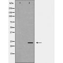 DF6595 at 1/100 staining Rat lung tissue by IHC-P. The sample was formaldehyde fixed and a heat mediated antigen retrieval step in citrate buffer was performed. The sample was then blocked and incubated with the antibody for 1.5 hours at 22¡ãC. An HRP conjugated goat anti-rabbit antibody was used as the secondary