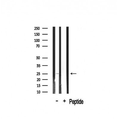 Western blot analysis on mouse brain lysate using Claudin 2 Antibody