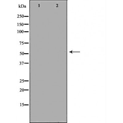 DF6598 staining LOVO by IF/ICC. The sample were fixed with PFA and permeabilized in 0.1% Triton X-100,then blocked in 10% serum for 45 minutes at 25¡ãC. The primary antibody was diluted at 1/200 and incubated with the sample for 1 hour at 37¡ãC. An  Alexa Fluor 594 conjugated goat anti-rabbit IgG (H+L) Ab, diluted at 1/600, was used as the secondary antibod