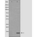 DF6599 at 1/100 staining Human prostate tissue by IHC-P. The sample was formaldehyde fixed and a heat mediated antigen retrieval step in citrate buffer was performed. The sample was then blocked and incubated with the antibody for 1.5 hours at 22¡ãC. An HRP conjugated goat anti-rabbit antibody was used as the secondary