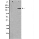 DF6600 at 1/100 staining Rat liver tissue by IHC-P. The sample was formaldehyde fixed and a heat mediated antigen retrieval step in citrate buffer was performed. The sample was then blocked and incubated with the antibody for 1.5 hours at 22¡ãC. An HRP conjugated goat anti-rabbit antibody was used as the secondary