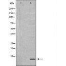 DF6607 at 1/100 staining Mouse liver tissue by IHC-P. The sample was formaldehyde fixed and a heat mediated antigen retrieval step in citrate buffer was performed. The sample was then blocked and incubated with the antibody for 1.5 hours at 22¡ãC. An HRP conjugated goat anti-rabbit antibody was used as the secondary