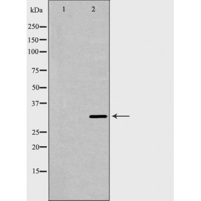 DF6608 at 1/100 staining Human heart tissue by IHC-P. The sample was formaldehyde fixed and a heat mediated antigen retrieval step in citrate buffer was performed. The sample was then blocked and incubated with the antibody for 1.5 hours at 22¡ãC. An HRP conjugated goat anti-rabbit antibody was used as the secondary