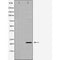 DF6616 at 1/100 staining Rat heart tissue by IHC-P. The sample was formaldehyde fixed and a heat mediated antigen retrieval step in citrate buffer was performed. The sample was then blocked and incubated with the antibody for 1.5 hours at 22¡ãC. An HRP conjugated goat anti-rabbit antibody was used as the secondary