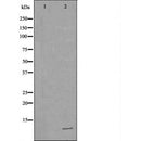 DF6619 at 1/100 staining Human Melanoma tissue by IHC-P. The sample was formaldehyde fixed and a heat mediated antigen retrieval step in citrate buffer was performed. The sample was then blocked and incubated with the antibody for 1.5 hours at 22¡ãC. An HRP conjugated goat anti-rabbit antibody was used as the secondary