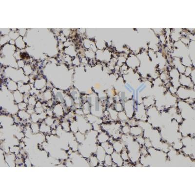 DF6621 staining HepG2 by IF/ICC. The sample were fixed with PFA and permeabilized in 0.1% Triton X-100,then blocked in 10% serum for 45 minutes at 25¡ãC. The primary antibody was diluted at 1/200 and incubated with the sample for 1 hour at 37¡ãC. An  Alexa Fluor 594 conjugated goat anti-rabbit IgG (H+L) Ab, diluted at 1/600, was used as the secondary antibod