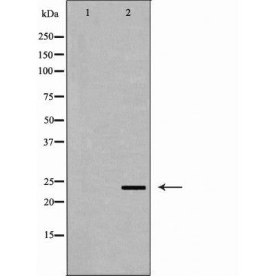 DF6623 at 1/100 staining Mouse liver tissue by IHC-P. The sample was formaldehyde fixed and a heat mediated antigen retrieval step in citrate buffer was performed. The sample was then blocked and incubated with the antibody for 1.5 hours at 22¡ãC. An HRP conjugated goat anti-rabbit antibody was used as the secondary