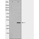 DF6624 at 1/100 staining Mouse spleen tissue by IHC-P. The sample was formaldehyde fixed and a heat mediated antigen retrieval step in citrate buffer was performed. The sample was then blocked and incubated with the antibody for 1.5 hours at 22¡ãC. An HRP conjugated goat anti-rabbit antibody was used as the secondary