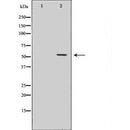 DF6625 at 1/100 staining Human prostate tissue by IHC-P. The sample was formaldehyde fixed and a heat mediated antigen retrieval step in citrate buffer was performed. The sample was then blocked and incubated with the antibody for 1.5 hours at 22¡ãC. An HRP conjugated goat anti-rabbit antibody was used as the secondary
