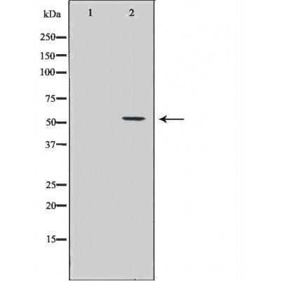 DF6625 at 1/100 staining Human prostate tissue by IHC-P. The sample was formaldehyde fixed and a heat mediated antigen retrieval step in citrate buffer was performed. The sample was then blocked and incubated with the antibody for 1.5 hours at 22¡ãC. An HRP conjugated goat anti-rabbit antibody was used as the secondary