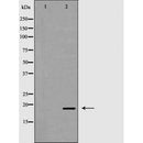 DF6627 at 1/100 staining Human uterus tissue by IHC-P. The sample was formaldehyde fixed and a heat mediated antigen retrieval step in citrate buffer was performed. The sample was then blocked and incubated with the antibody for 1.5 hours at 22¡ãC. An HRP conjugated goat anti-rabbit antibody was used as the secondary