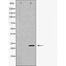 DF6631 at 1/100 staining Mouse lung tissue by IHC-P. The sample was formaldehyde fixed and a heat mediated antigen retrieval step in citrate buffer was performed. The sample was then blocked and incubated with the antibody for 1.5 hours at 22¡ãC. An HRP conjugated goat anti-rabbit antibody was used as the secondary