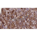 Western blot analysis of extracts from B16F10, using SLC22A6 Antibody. The lane on the left was treated with blocking peptide.