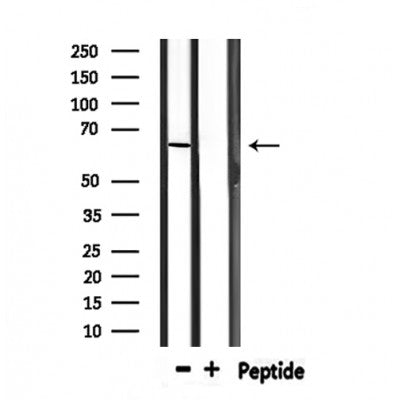 Western blot analysis of extracts from rat brain and mouse brain, using PTBP1 Antibody.