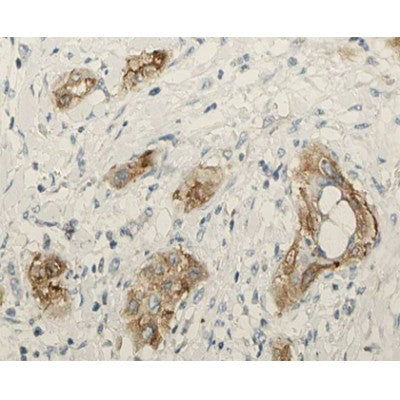 DF6647 staining HepG2? cells by IF/ICC. The sample were fixed with PFA and permeabilized in 0.1% Triton X-100,then blocked in 10% serum for 45 minutes at 25¡ãC. The primary antibody was diluted at 1/200 and incubated with the sample for 1 hour at 37¡ãC. An  Alexa Fluor 594 conjugated goat anti-rabbit IgG (H+L) antibody(Cat.