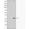 DF6648 at 1/100 staining Mouse pancreas tissue by IHC-P. The sample was formaldehyde fixed and a heat mediated antigen retrieval step in citrate buffer was performed. The sample was then blocked and incubated with the antibody for 1.5 hours at 22¡ãC. An HRP conjugated goat anti-rabbit antibody was used as the secondary