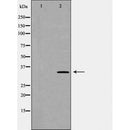 CD47 Antibody for IHC in human kidney