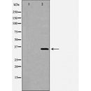 DF6650 at 1/100 staining Human pancreas tissue by IHC-P. The sample was formaldehyde fixed and a heat mediated antigen retrieval step in citrate buffer was performed. The sample was then blocked and incubated with the antibody for 1.5 hours at 22¡ãC. An HRP conjugated goat anti-rabbit antibody was used as the secondary