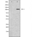 DF6654 at 1/100 staining Mouse liver tissue by IHC-P. The sample was formaldehyde fixed and a heat mediated antigen retrieval step in citrate buffer was performed. The sample was then blocked and incubated with the antibody for 1.5 hours at 22¡ãC. An HRP conjugated goat anti-rabbit antibody was used as the secondary