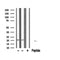 DF6660 staining Hela by IF/ICC. The sample were fixed with PFA and permeabilized in 0.1% Triton X-100,then blocked in 10% serum for 45 minutes at 25¡ãC. The primary antibody was diluted at 1/200 and incubated with the sample for 1 hour at 37¡ãC. An  Alexa Fluor 594 conjugated goat anti-rabbit IgG (H+L) Ab, diluted at 1/600, was used as the secondary antibod