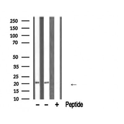 DF6660 staining Hela by IF/ICC. The sample were fixed with PFA and permeabilized in 0.1% Triton X-100,then blocked in 10% serum for 45 minutes at 25¡ãC. The primary antibody was diluted at 1/200 and incubated with the sample for 1 hour at 37¡ãC. An  Alexa Fluor 594 conjugated goat anti-rabbit IgG (H+L) Ab, diluted at 1/600, was used as the secondary antibod