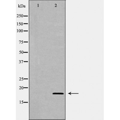 DF6669 at 1/100 staining Human uterus tissue by IHC-P. The sample was formaldehyde fixed and a heat mediated antigen retrieval step in citrate buffer was performed. The sample was then blocked and incubated with the antibody for 1.5 hours at 22¡ãC. An HRP conjugated goat anti-rabbit antibody was used as the secondary