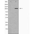 DF6677 at 1/100 staining Human gastric tissue by IHC-P. The sample was formaldehyde fixed and a heat mediated antigen retrieval step in citrate buffer was performed. The sample was then blocked and incubated with the antibody for 1.5 hours at 22¡ãC. An HRP conjugated goat anti-rabbit antibody was used as the secondary