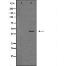DF6678 at 1/100 staining Rat liver tissue by IHC-P. The sample was formaldehyde fixed and a heat mediated antigen retrieval step in citrate buffer was performed. The sample was then blocked and incubated with the antibody for 1.5 hours at 22¡ãC. An HRP conjugated goat anti-rabbit antibody was used as the secondary