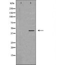 DF6680 at 1/100 staining Human breast cancer tissue by IHC-P. The sample was formaldehyde fixed and a heat mediated antigen retrieval step in citrate buffer was performed. The sample was then blocked and incubated with the antibody for 1.5 hours at 22¡ãC. An HRP conjugated goat anti-rabbit antibody was used as the secondary