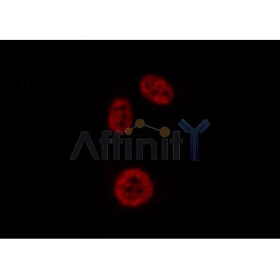 Western blot analysis of extracts from mouse heart and HepG2, using PADI4 Antibody.