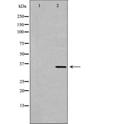 DF6690 staining Hela by IF/ICC. The sample were fixed with PFA and permeabilized in 0.1% Triton X-100,then blocked in 10% serum for 45 minutes at 25¡ãC. The primary antibody was diluted at 1/200 and incubated with the sample for 1 hour at 37¡ãC. An  Alexa Fluor 594 conjugated goat anti-rabbit IgG (H+L) Ab, diluted at 1/600, was used as the secondary antibod