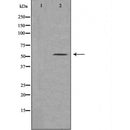 DF6694 at 1/100 staining Human urothelial cancer tissue by IHC-P. The sample was formaldehyde fixed and a heat mediated antigen retrieval step in citrate buffer was performed. The sample was then blocked and incubated with the antibody for 1.5 hours at 22¡ãC. An HRP conjugated goat anti-rabbit antibody was used as the secondary
