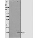 DF6695 at 1/100 staining Human uterus tissue by IHC-P. The sample was formaldehyde fixed and a heat mediated antigen retrieval step in citrate buffer was performed. The sample was then blocked and incubated with the antibody for 1.5 hours at 22¡ãC. An HRP conjugated goat anti-rabbit antibody was used as the secondary