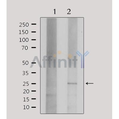 Western blot analysis of extracts from HepG2, using Claudin 3 Antibody. Lane 1 was treated with the antigen-specific peptide.