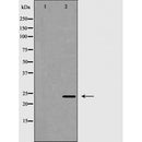 DF6702 at 1/100 staining Mouse kidney tissue by IHC-P. The sample was formaldehyde fixed and a heat mediated antigen retrieval step in citrate buffer was performed. The sample was then blocked and incubated with the antibody for 1.5 hours at 22¡ãC. An HRP conjugated goat anti-rabbit antibody was used as the secondary
