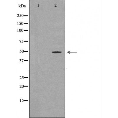 DF6705 at 1/100 staining Mouse testis tissue by IHC-P. The sample was formaldehyde fixed and a heat mediated antigen retrieval step in citrate buffer was performed. The sample was then blocked and incubated with the antibody for 1.5 hours at 22¡ãC. An HRP conjugated goat anti-rabbit antibody was used as the secondary