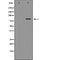 DF6708 at 1/100 staining Human liver tissue by IHC-P. The sample was formaldehyde fixed and a heat mediated antigen retrieval step in citrate buffer was performed. The sample was then blocked and incubated with the antibody for 1.5 hours at 22¡ãC. An HRP conjugated goat anti-rabbit antibody was used as the secondary