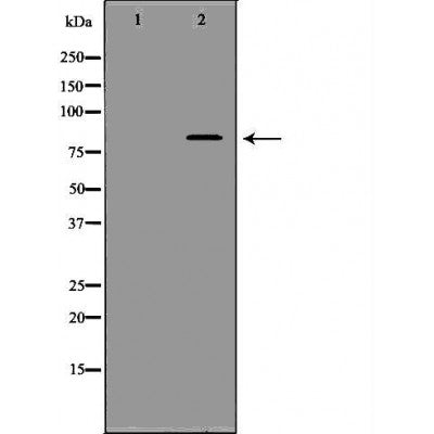 DF6708 at 1/100 staining Human liver tissue by IHC-P. The sample was formaldehyde fixed and a heat mediated antigen retrieval step in citrate buffer was performed. The sample was then blocked and incubated with the antibody for 1.5 hours at 22¡ãC. An HRP conjugated goat anti-rabbit antibody was used as the secondary