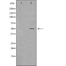 DF6709 at 1/100 staining Human urothelial cancer tissue by IHC-P. The sample was formaldehyde fixed and a heat mediated antigen retrieval step in citrate buffer was performed. The sample was then blocked and incubated with the antibody for 1.5 hours at 22¡ãC. An HRP conjugated goat anti-rabbit antibody was used as the secondary