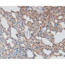Western blot analysis of extracts of lung tissue, using GPC3 antibody. The lane on the left is treated with the antigen-specific peptide.