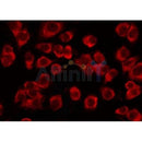 Western blot analysis of extracts from Rat brain, using TCP1  Antibody. The lane on the left was treated with blocking peptide.