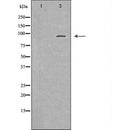 DF6716 at 1/100 staining Rat lung tissue by IHC-P. The sample was formaldehyde fixed and a heat mediated antigen retrieval step in citrate buffer was performed. The sample was then blocked and incubated with the antibody for 1.5 hours at 22¡ãC. An HRP conjugated goat anti-rabbit antibody was used as the secondary