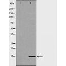 DF6718 at 1/100 staining Human gastric tissue by IHC-P. The sample was formaldehyde fixed and a heat mediated antigen retrieval step in citrate buffer was performed. The sample was then blocked and incubated with the antibody for 1.5 hours at 22¡ãC. An HRP conjugated goat anti-rabbit antibody was used as the secondary