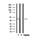 DF6719 at 1/100 staining Mouse lung tissue by IHC-P. The sample was formaldehyde fixed and a heat mediated antigen retrieval step in citrate buffer was performed. The sample was then blocked and incubated with the antibody for 1.5 hours at 22¡ãC. An HRP conjugated goat anti-rabbit antibody was used as the secondary